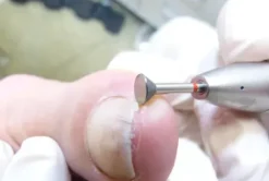 Busch Diamantschleifer Side Grip 8805S