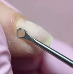 Magnetic The Curette