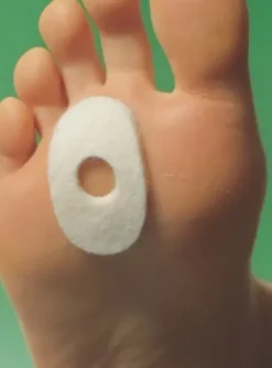 SÜDA Ballenring  oval